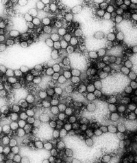 Virusul este unul de tip ARN aparținând genului Flavivirus
