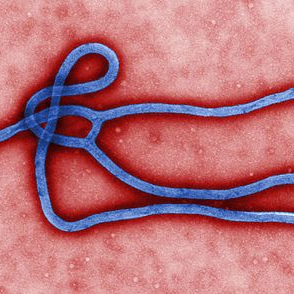 Boala virusului Ebola 