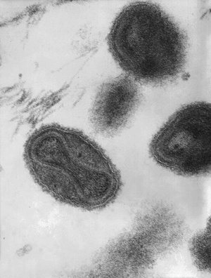 Virionii variolei (370.000 de ori măriți)