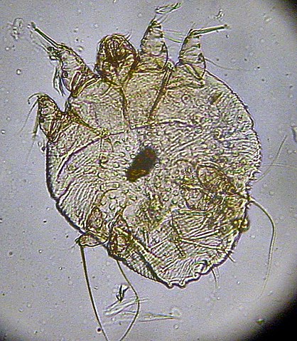 O microfotografie a unui acarien care mâncărime (S. scabiei)